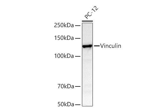 Vinculin Antibody (9I3Y8)