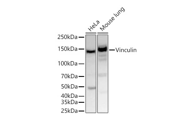 Vinculin Antibody (9I3Y8)