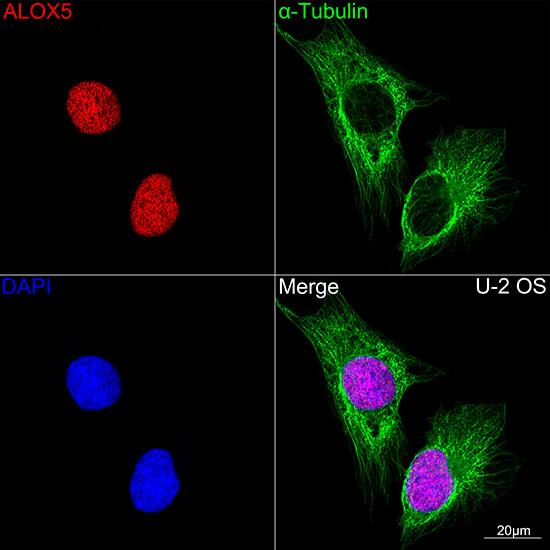 5-Lipoxygenase Antibody (5C5Z2)