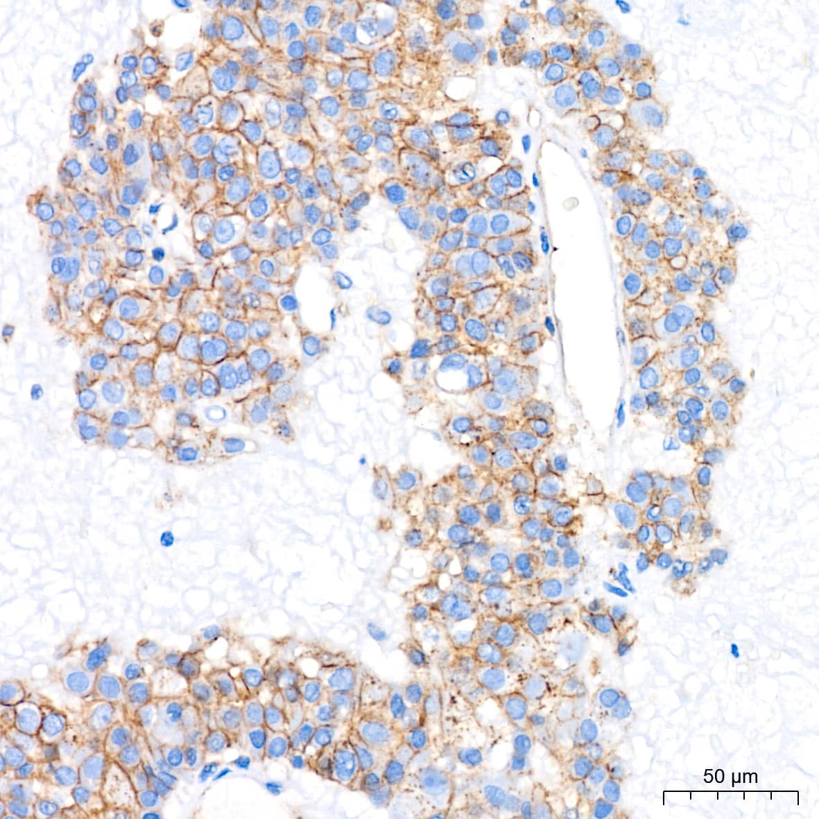 Flotillin-1 Antibody (8I2S7)