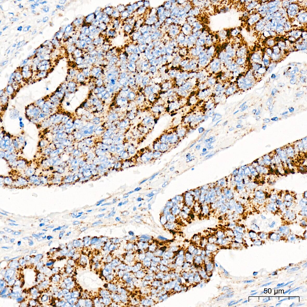 mtTFA Antibody (4H2M9)
