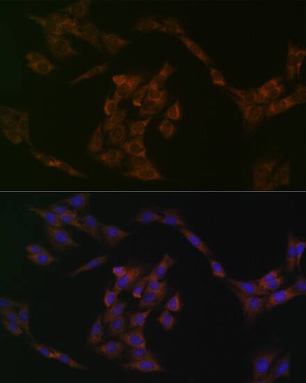 IRF6 Antibody (5D1Z4)