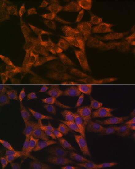 IRF6 Antibody (5D1Z4)