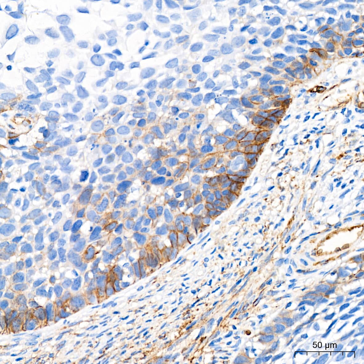 Cadherin-13 Antibody (4Z8D1)