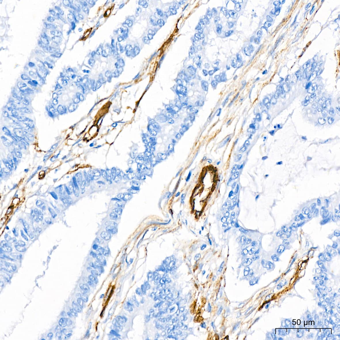 Cadherin-13 Antibody (4Z8D1)