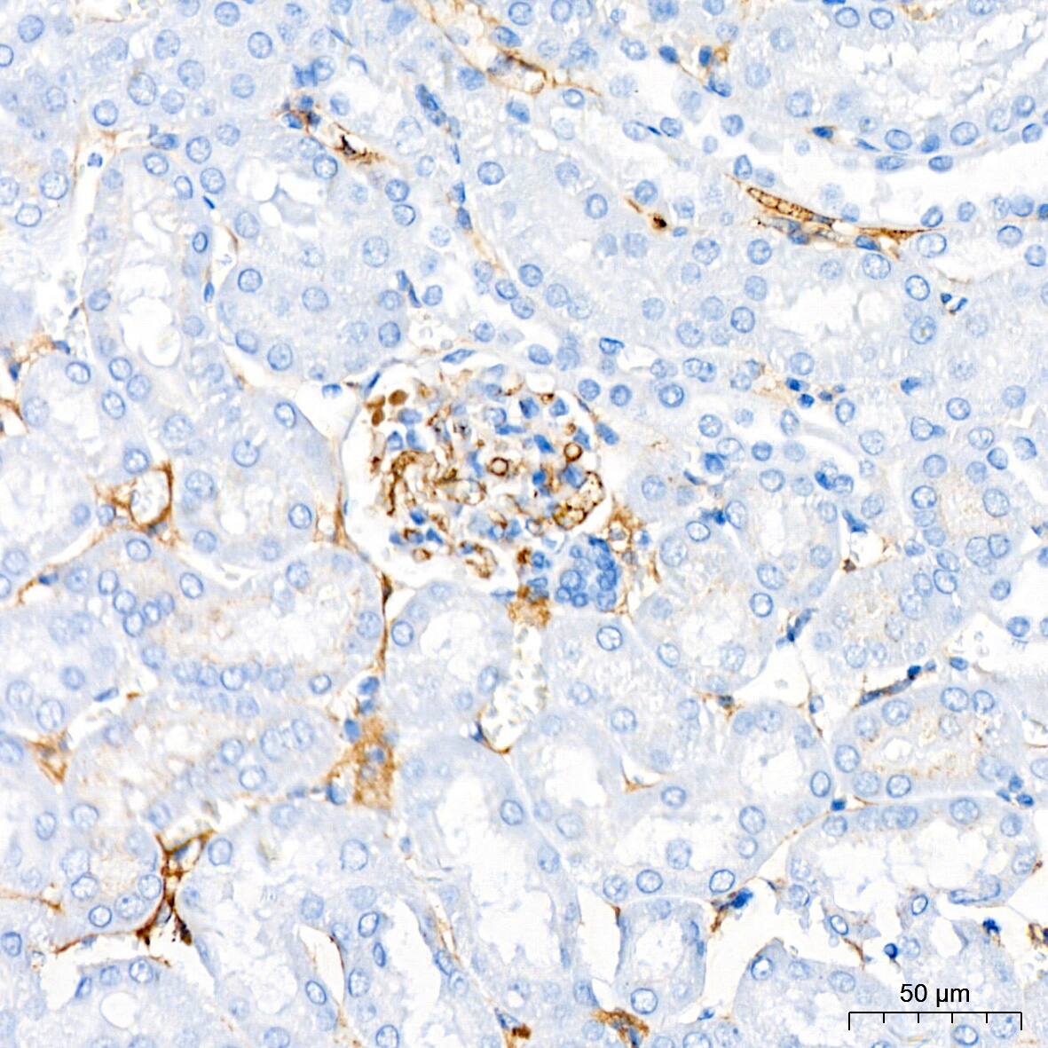 Cadherin-13 Antibody (4Z8D1)