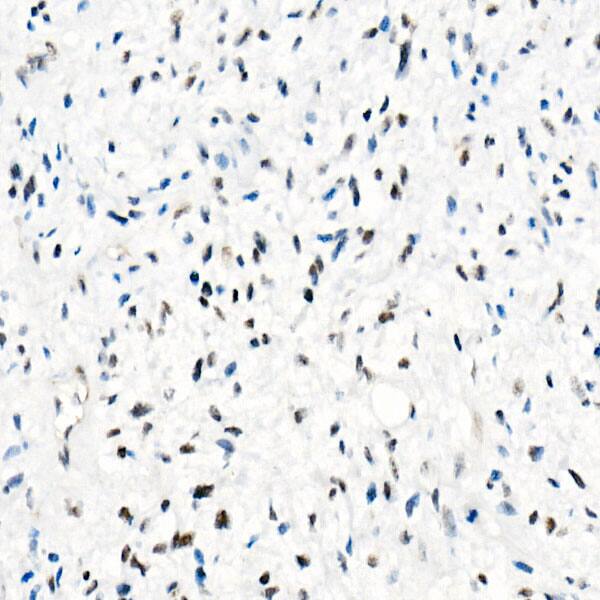 SNF5 Antibody (9A9G0)