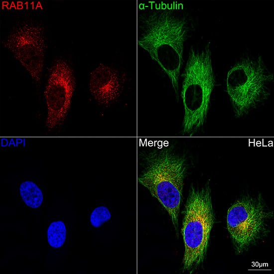 Rab11A Antibody (3O4R8)