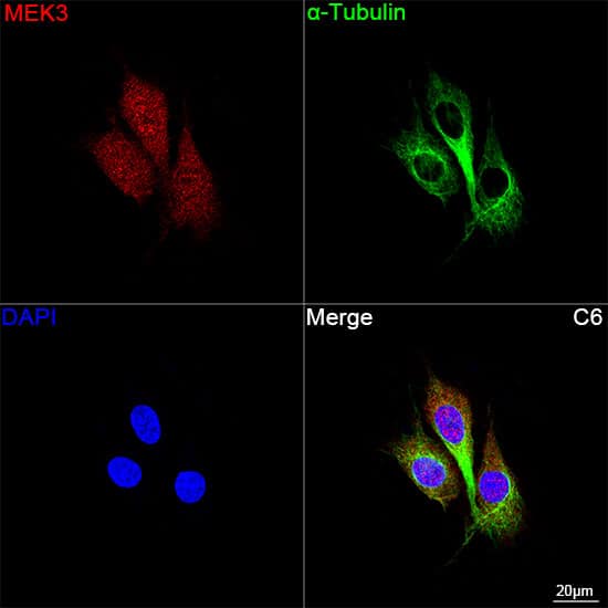 MKK3/MEK3 Antibody (8U2X3)