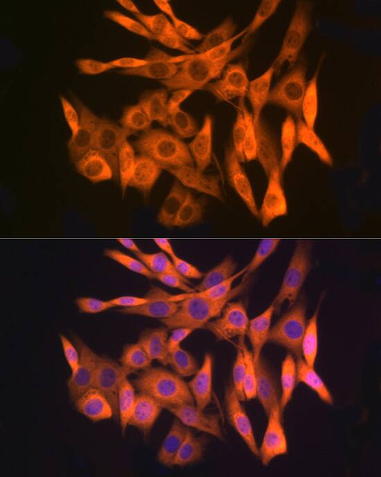 GLI-3 Antibody (8B1E2)
