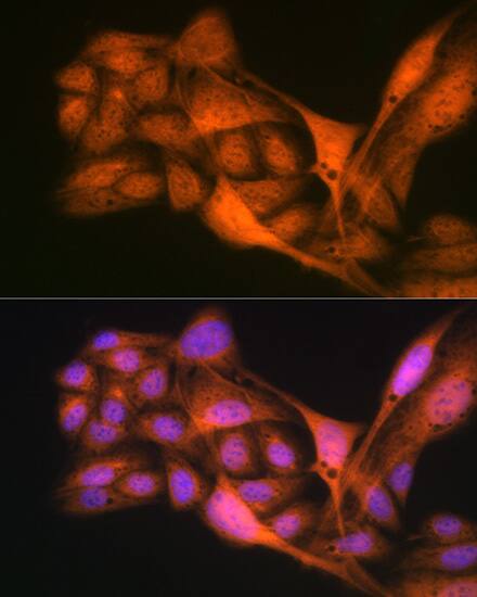GLI-3 Antibody (8B1E2)