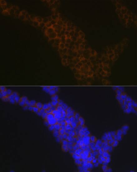 LSP1 Antibody (4U10N5)