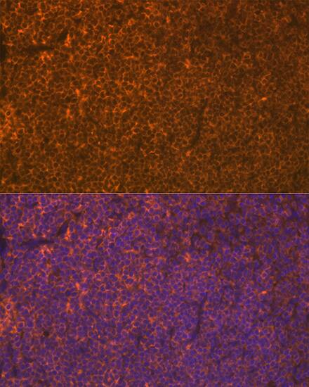 LSP1 Antibody (4U10N5)