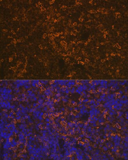LSP1 Antibody (4U10N5)