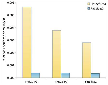 RPA70 Antibody (5R7S3)