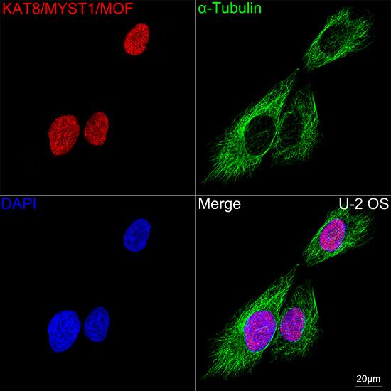 MYST1 Antibody (6U5Z6)