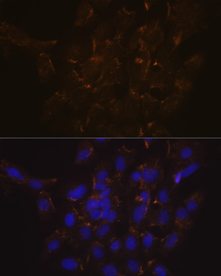 Phospholipid Scramblase 1/PLSCR1 Antibody (5U6G1)