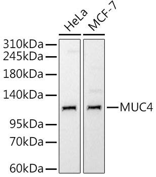 MUC4 Antibody (5J3R7)