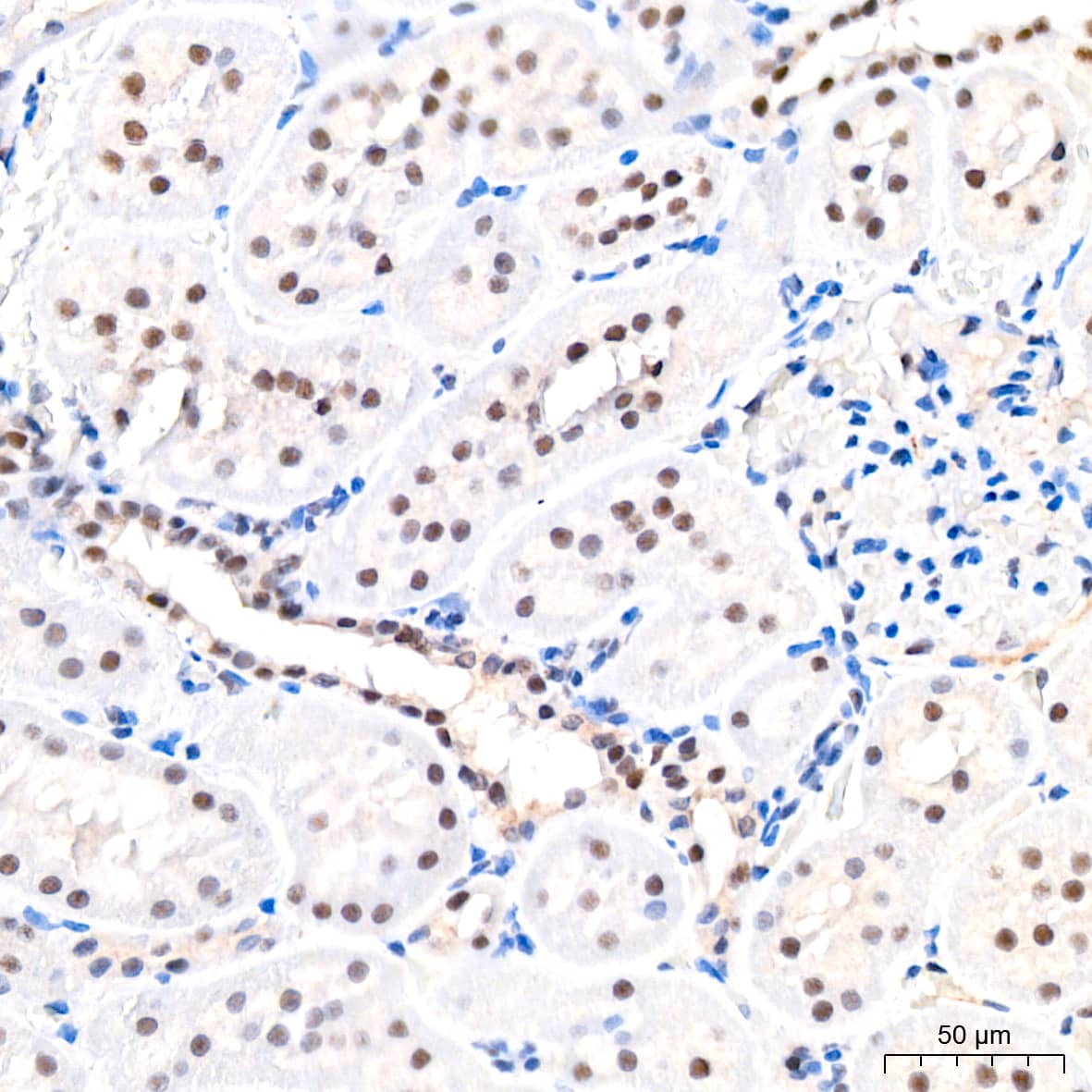 USP7 Antibody (3J7G1)
