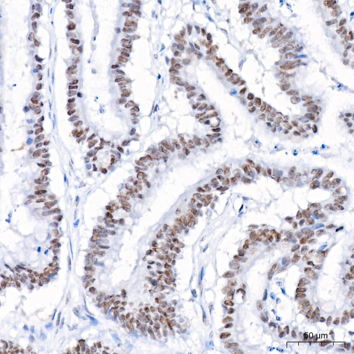 USP7 Antibody (3J7G1)