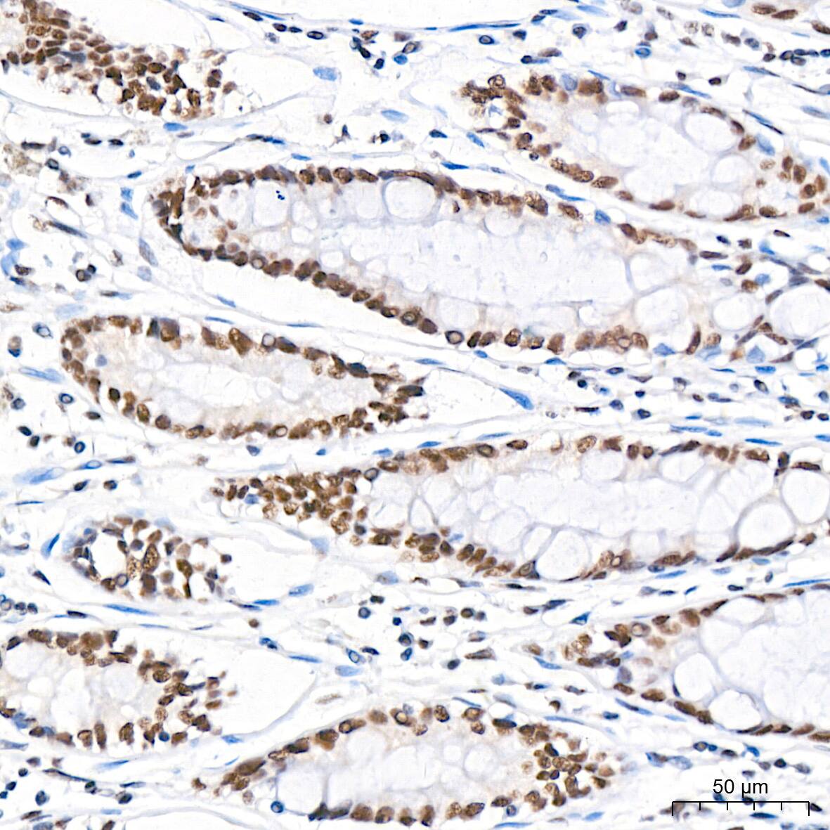 USP7 Antibody (3J7G1)