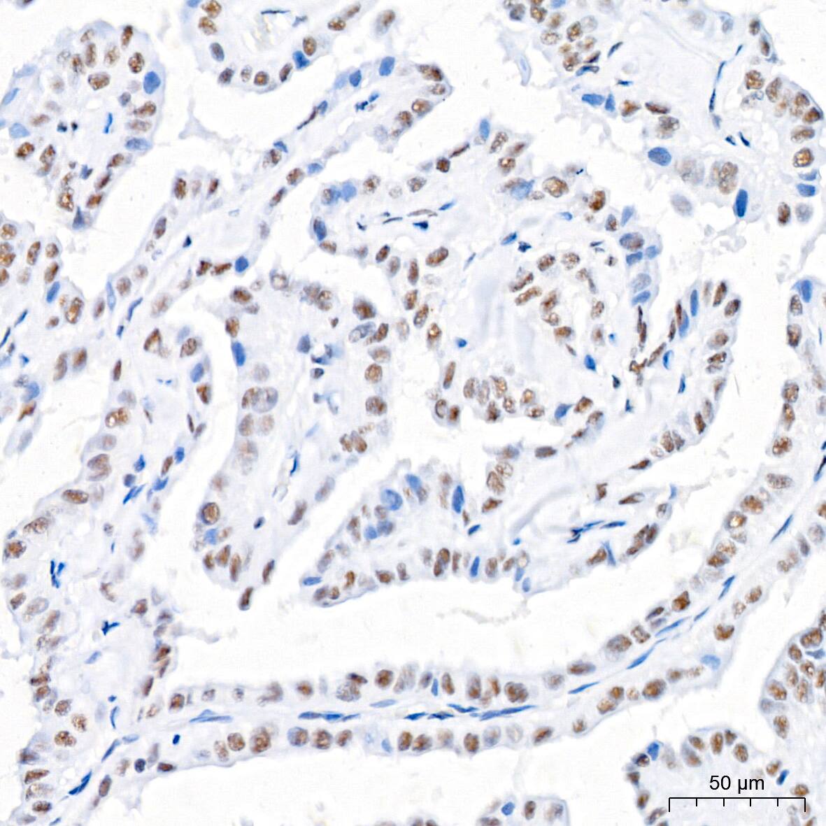 USP7 Antibody (3J7G1)