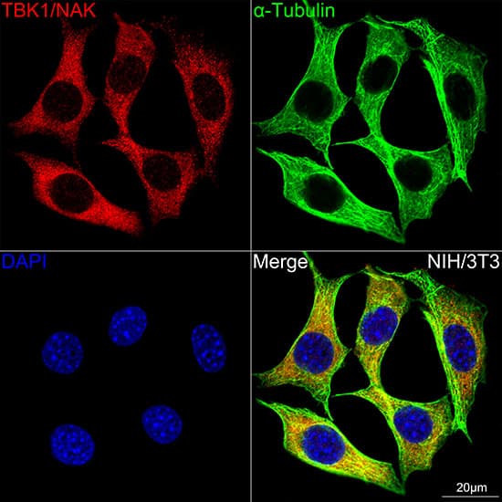 TBK1 Antibody (4G6C7)