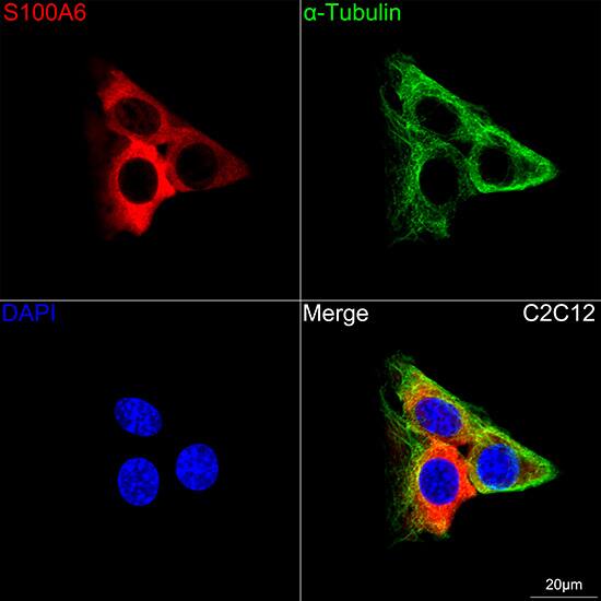 S100A6 Antibody (0J1Q5)
