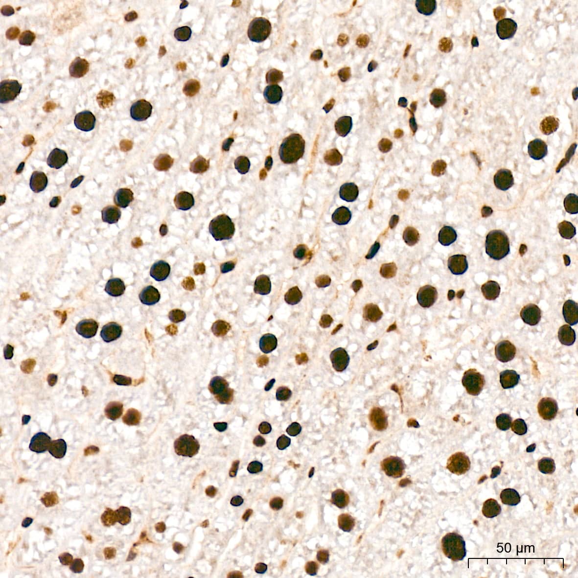ANP32B Antibody (4A8E5)