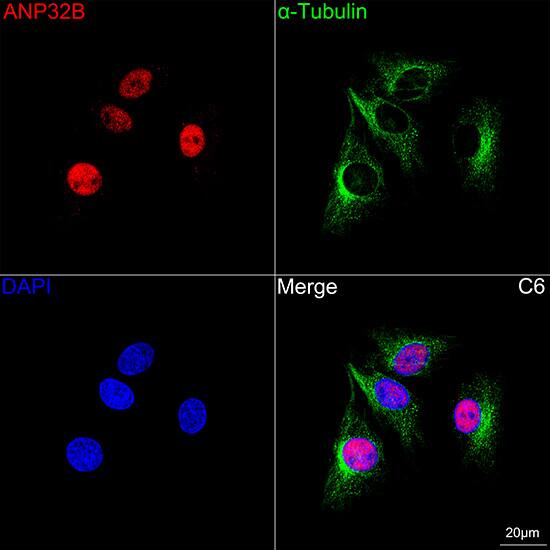 ANP32B Antibody (4A8E5)