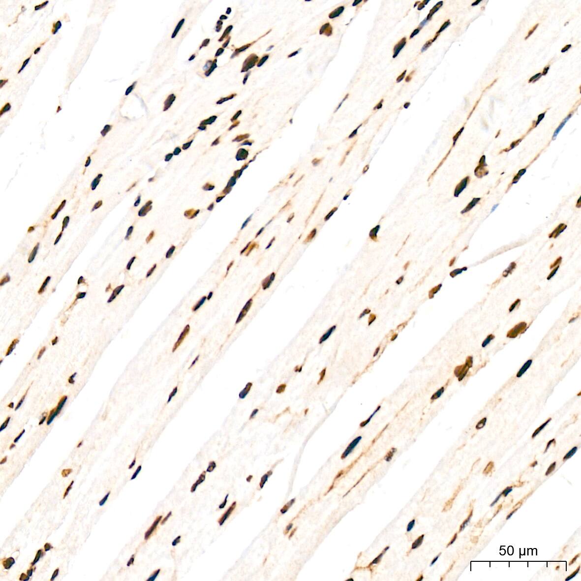 ANP32B Antibody (4A8E5)
