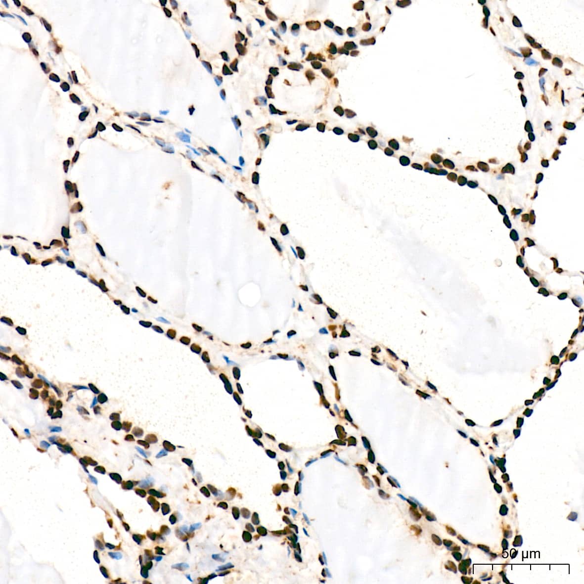 ANP32B Antibody (4A8E5)