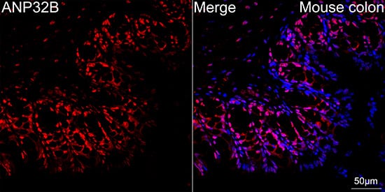 ANP32B Antibody (4A8E5)