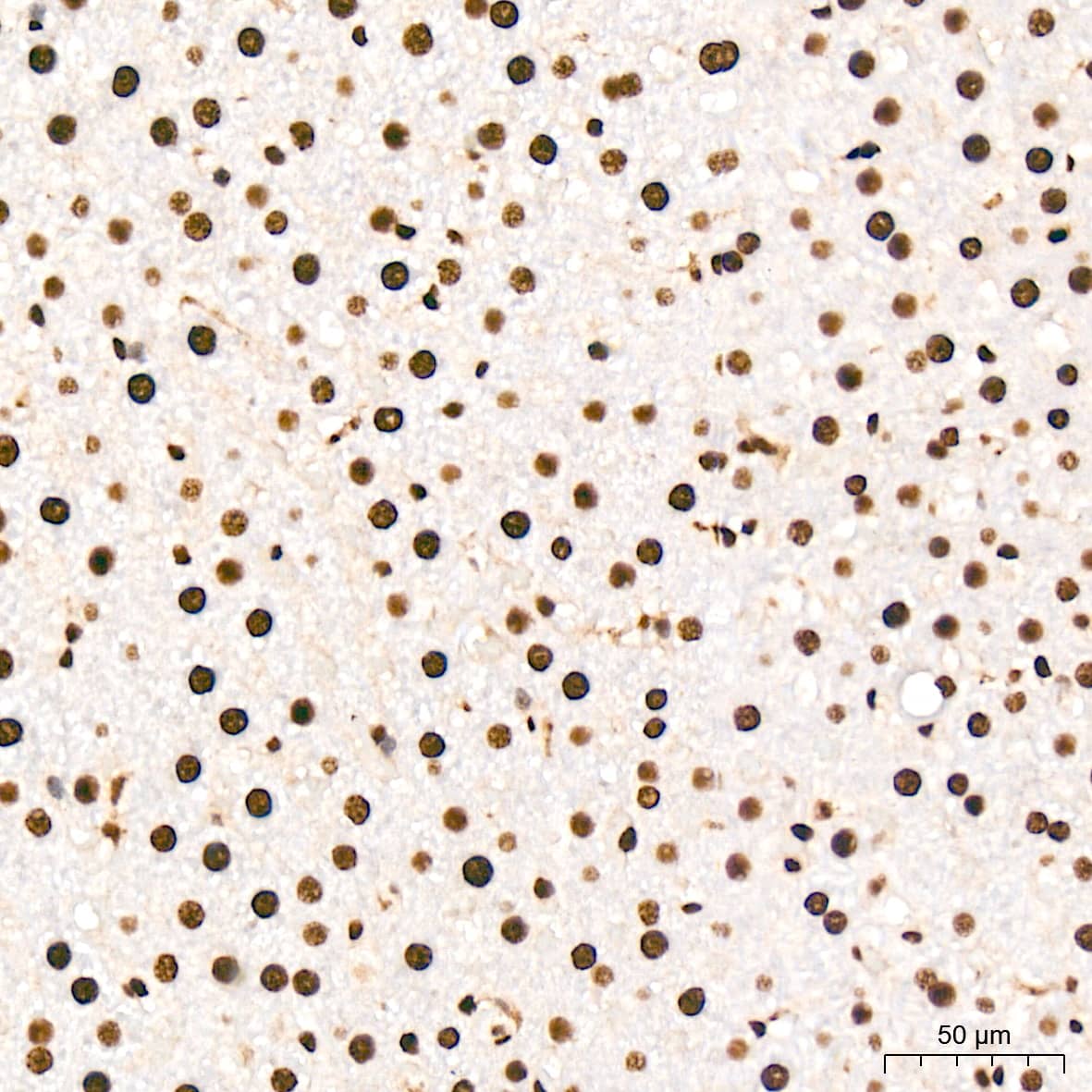 ANP32B Antibody (4A8E5)