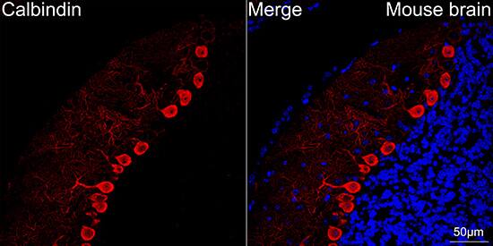 Calbindin D-28K Antibody (1K2K2)