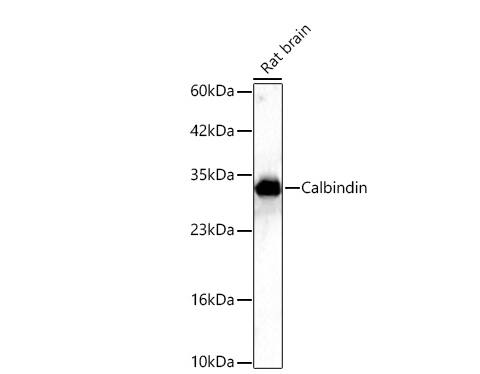 Calbindin D-28K Antibody (1K2K2)