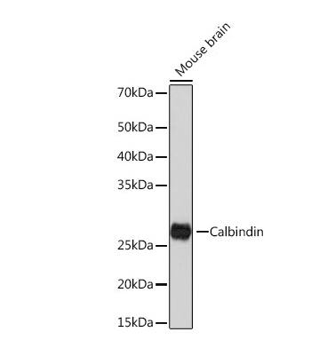 Calbindin D-28K Antibody (1K2K2)