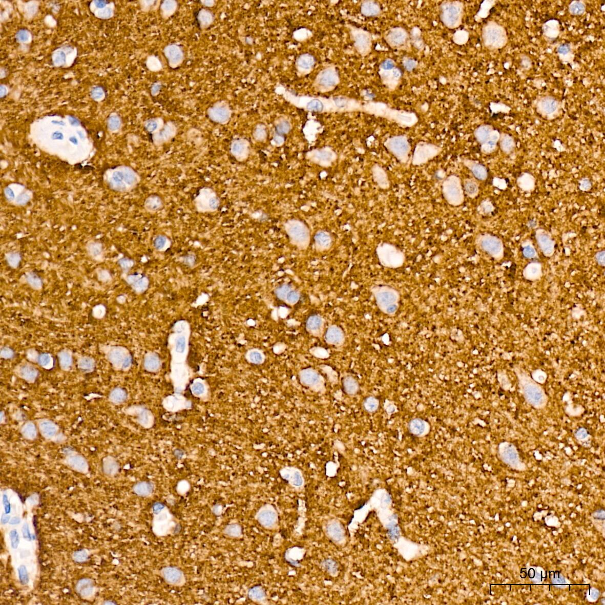 VAMP-1 Antibody (1A3K6)