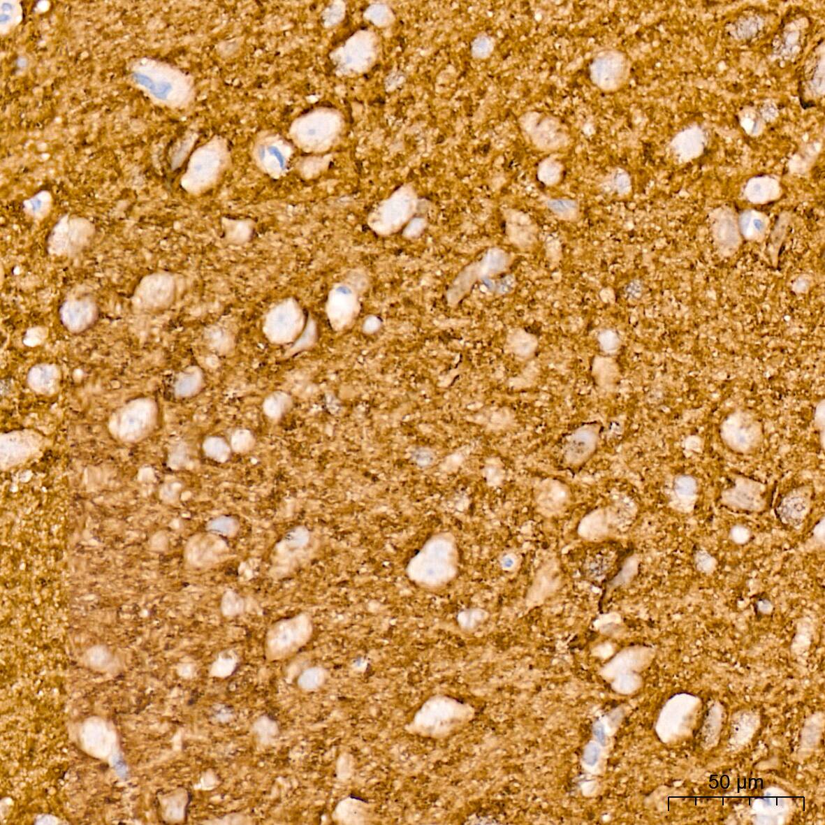 VAMP-1 Antibody (1A3K6)