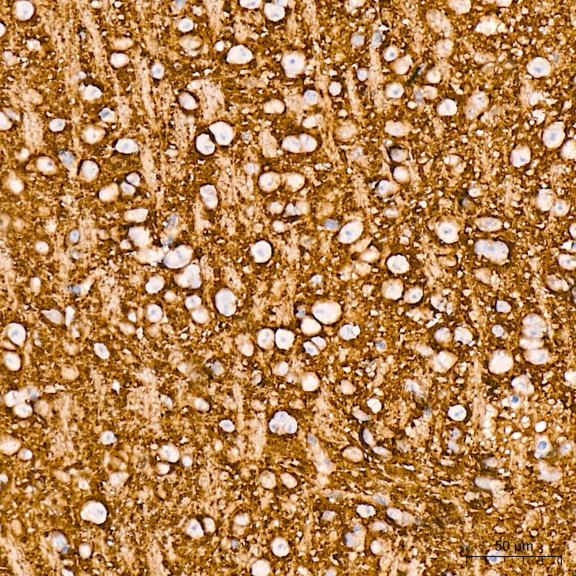 VAMP-1 Antibody (1A3K6)