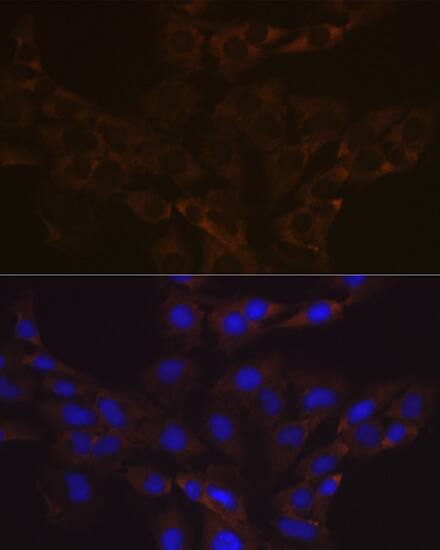 VAMP-1 Antibody (1A3K6)