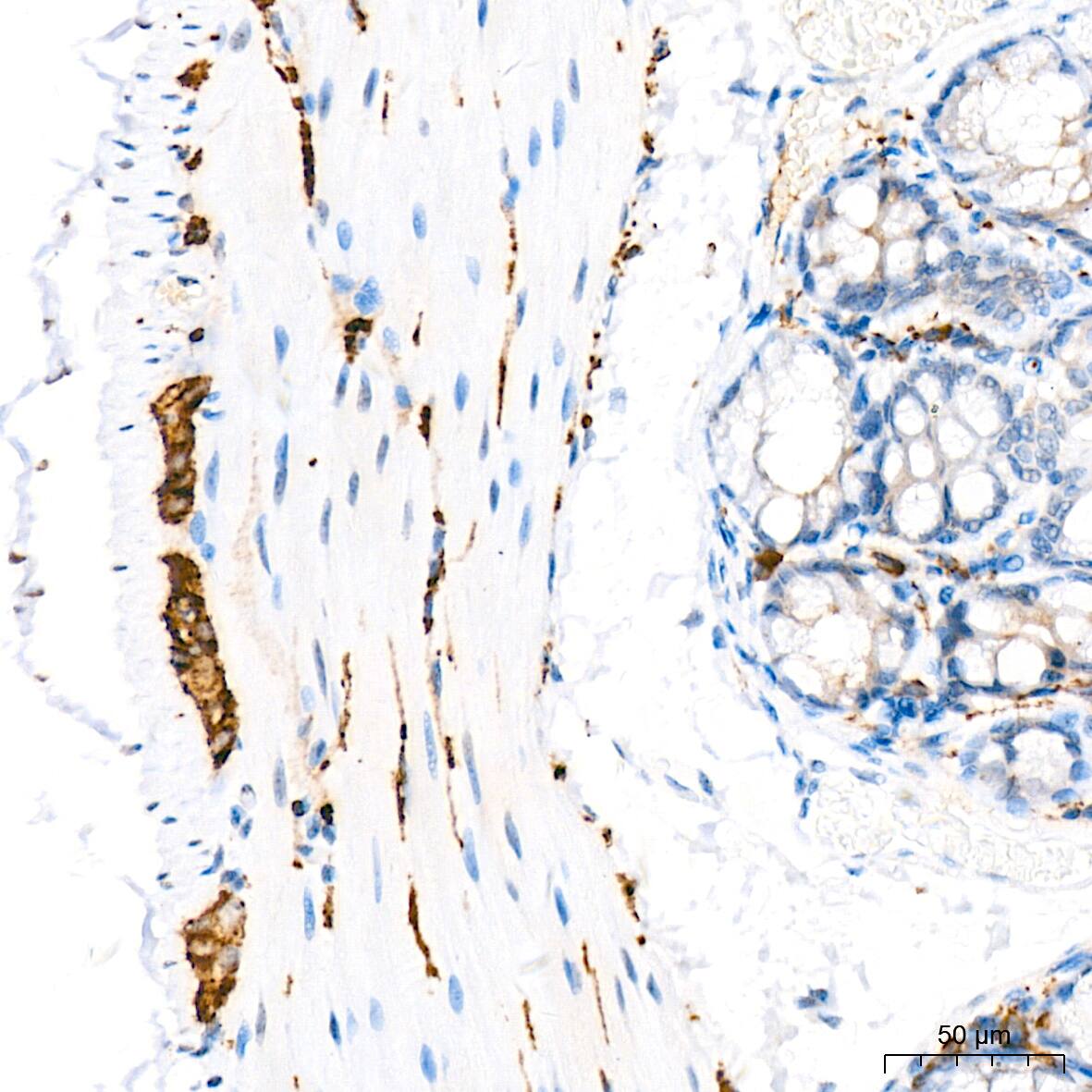VAMP-1 Antibody (1A3K6)