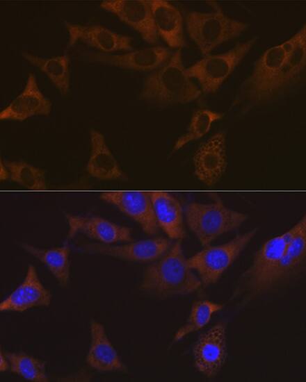 VAMP-1 Antibody (1A3K6)