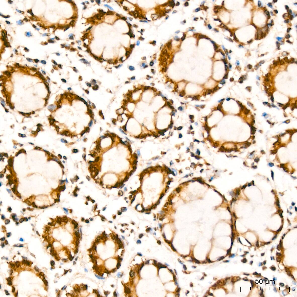 YB1 Antibody (9J7M4)