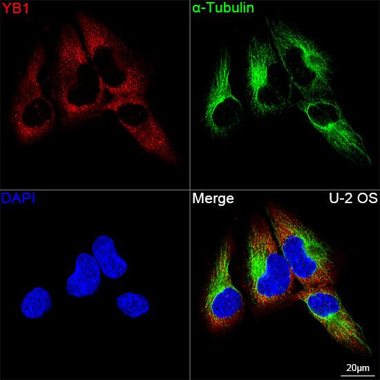 YB1 Antibody (9J7M4)