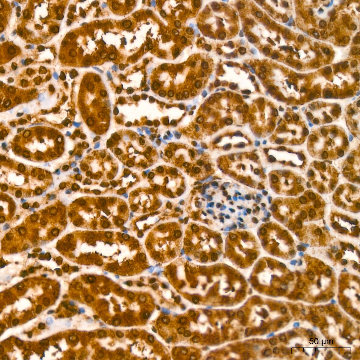 YB1 Antibody (9J7M4)