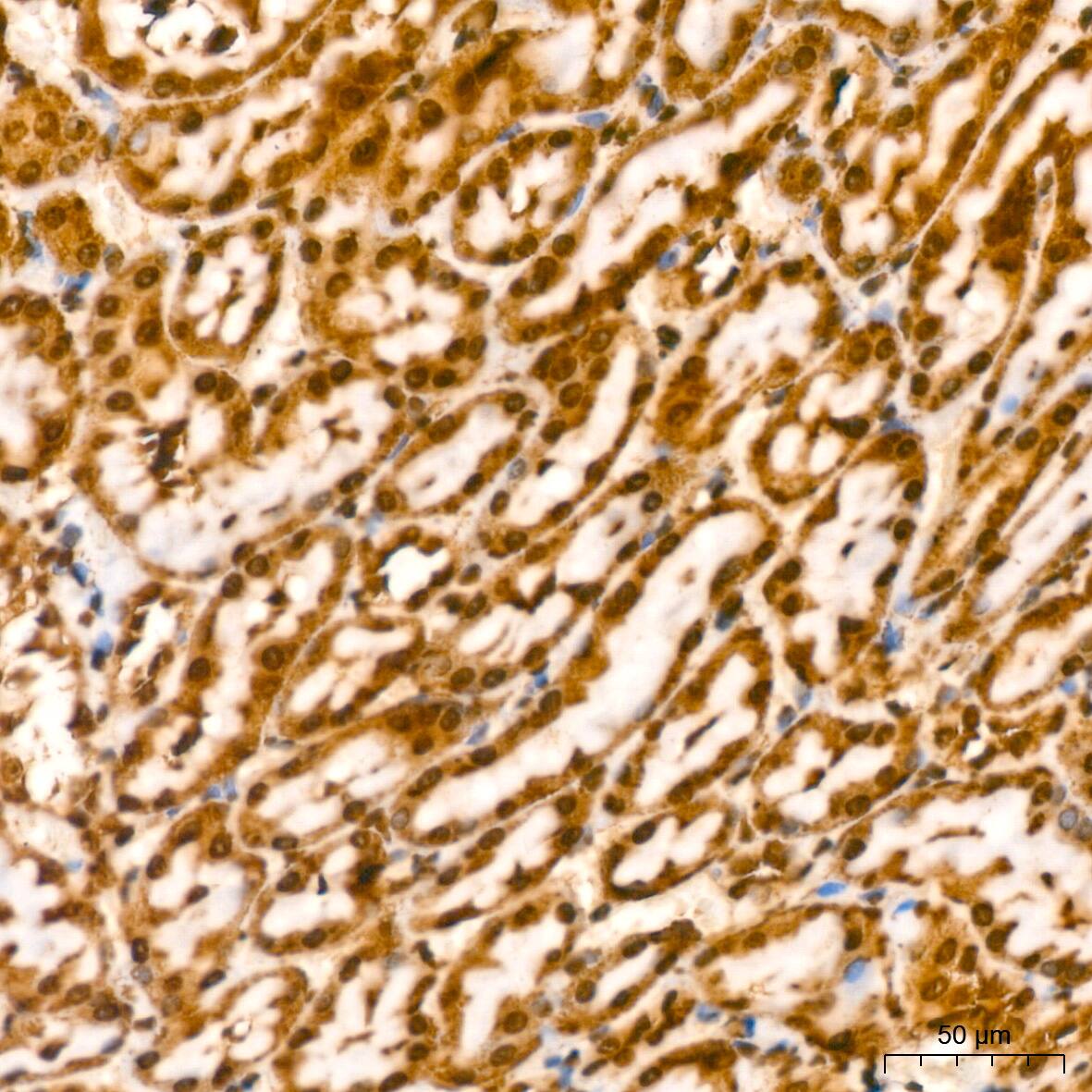 YB1 Antibody (9J7M4)