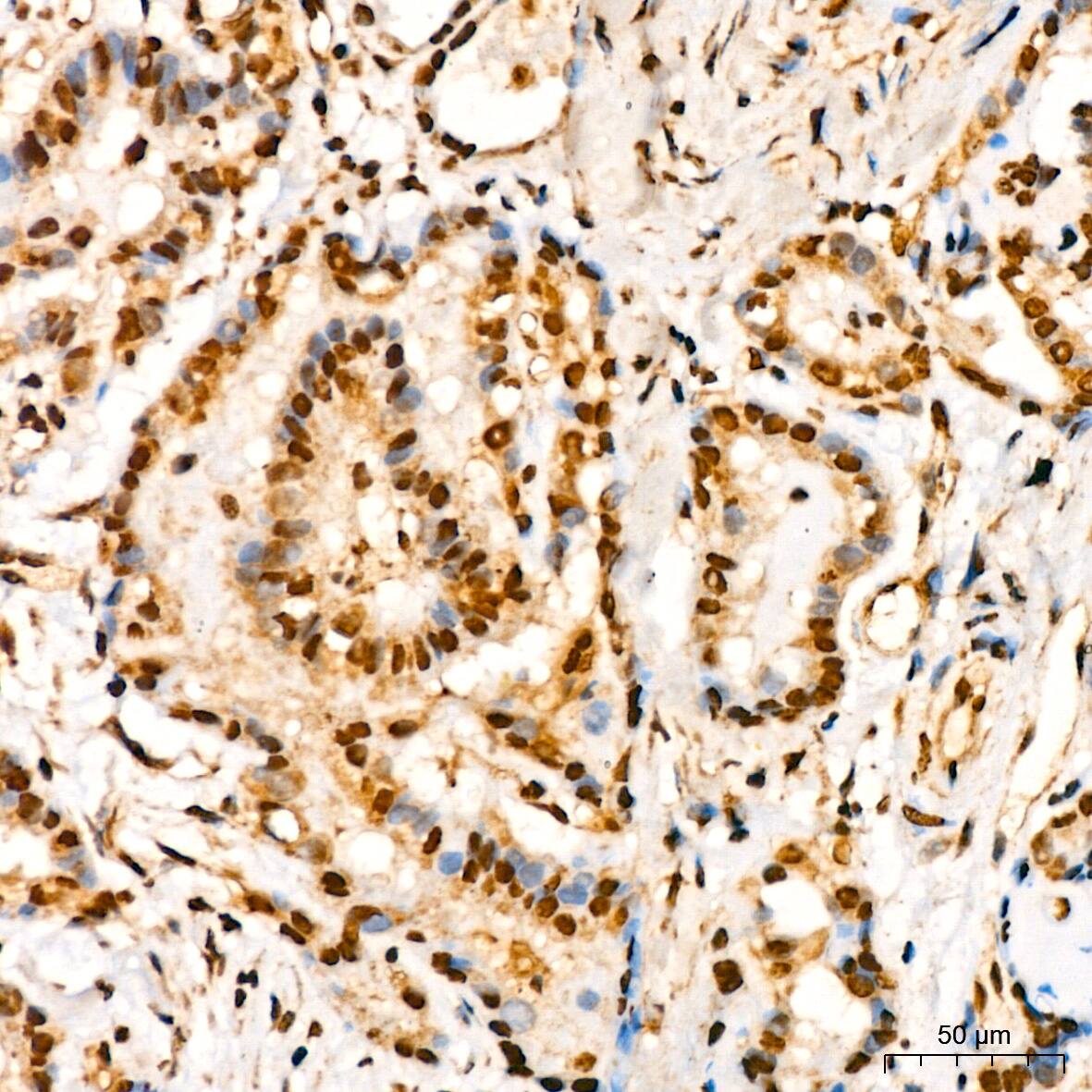 YB1 Antibody (9J7M4)