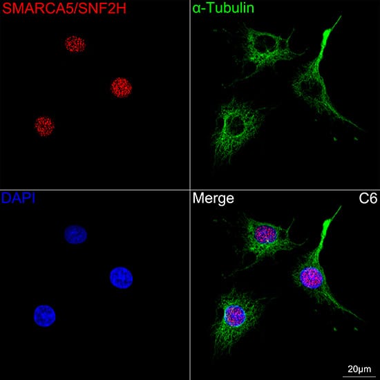 SMARCA5/SNF2H Antibody (6H8I7)