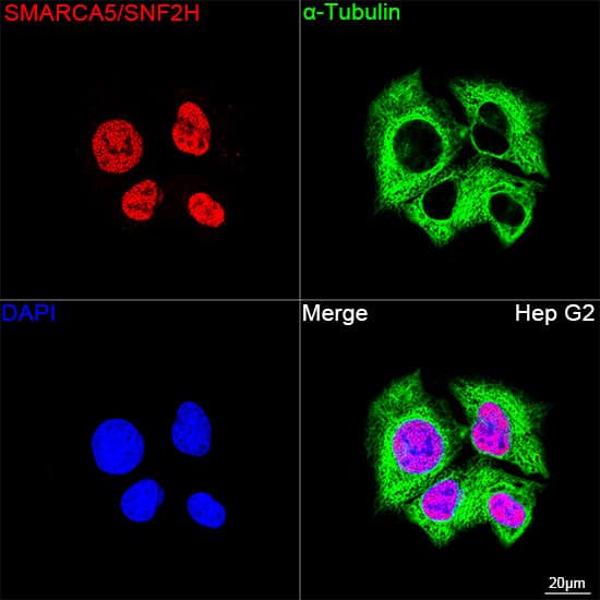 SMARCA5/SNF2H Antibody (6H8I7)